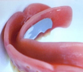 ソフト床義歯